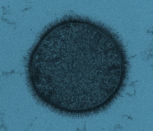 Heterotrophic Plate Count